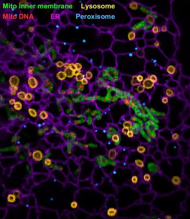 RmFicvQBAkgBUlicY1Eib8nBgpcwBKoNicI7CzJDqiaOIYibR3K4ibWbXvN3H21WtMCdpChGsXz2HTVlHcicYRMK7Tc4BQ