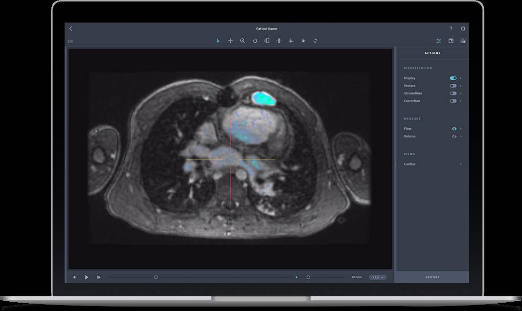 eicZhoGYCfyYXbmK5XIkRBDNDjYkn1yo1psvkUekibgwZic7VQdrHD2awHg6dM22wy4TXYQdC1icyrFOkYRT24nxIA