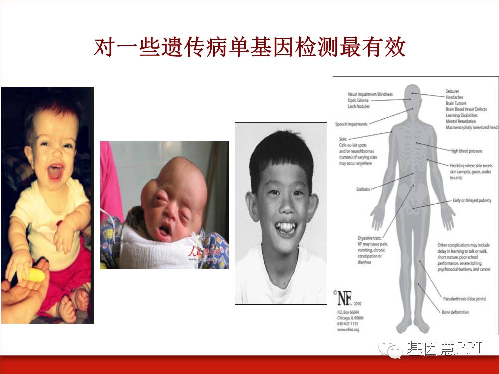 eicZhoGYCfyafJjQJnYJIhNcTlDmyh5WRNhqILmHjbEMlvbnYV9hPrhw6yNBg8hJs1w3S1NQd7Ry4JibyFDYb61g