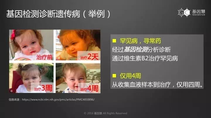 eicZhoGYCfybBkpH6f2nkBEHMcNGibArmme6VWq3ZSJ6mxCoicjhgFYD7RGS0qIO3c0YENDicyp2jjPgk30OGEX5HQ