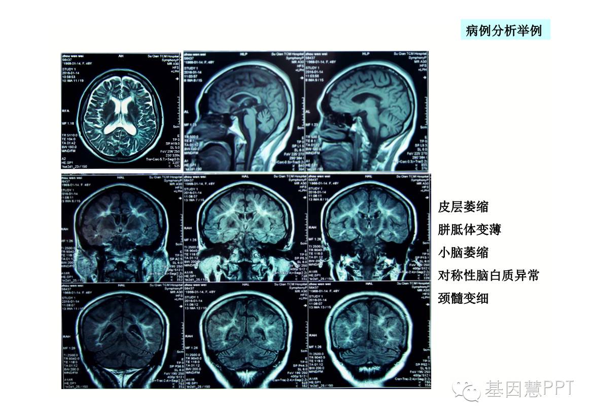 eicZhoGYCfybeta5TzFPCicoEwlY26Oeia4HbEEricmUsgib5yo5PuCfcyCW8ndGxJfUIgkebibfx7TkHrtNREn75twA