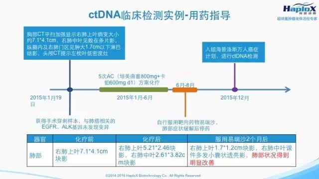 iaJU94oZ03r7aT7sOYryjGCHNyRI5l6KYMkFVibFJzZ62adk7EuSrn9doafnZTQJc85Iq2hFMAibibzokicC3WckMyw